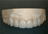Dr Andor temporary teeth