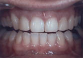 Dr Andor teeth before